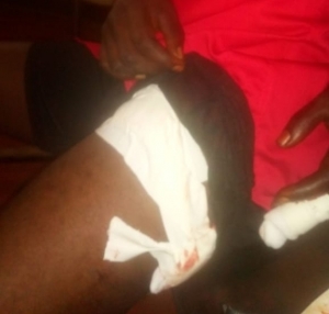 Des voleurs blessent un couple et volent de l’argent à Rugombo