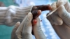 La malaria fait encore de victimes